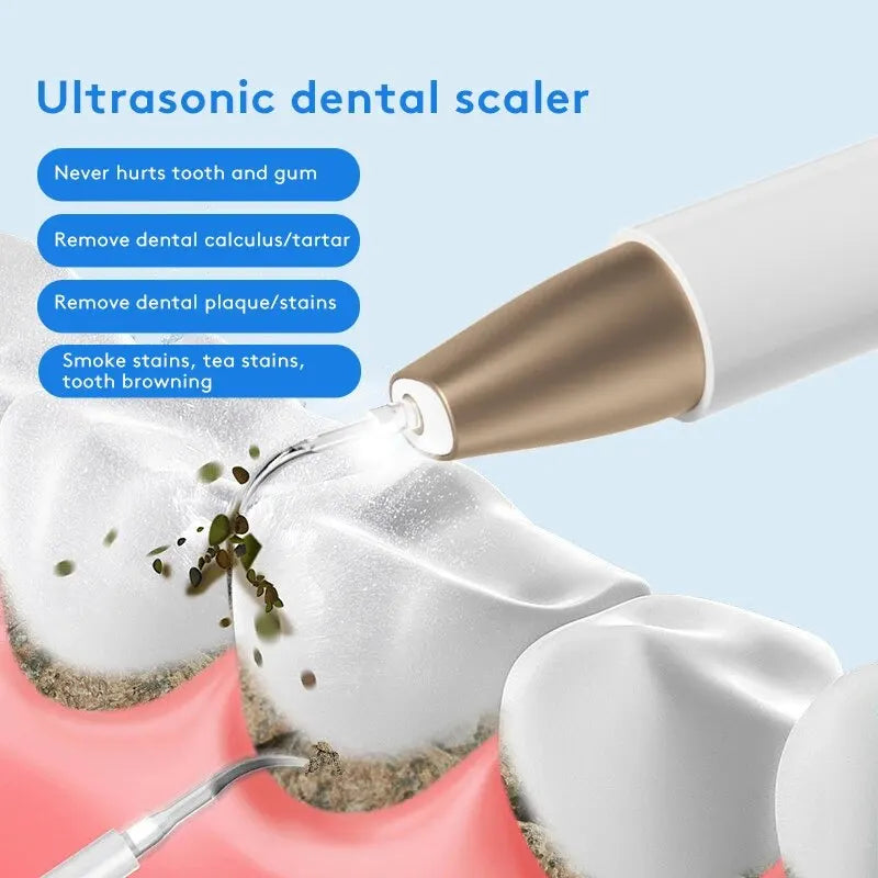 Ultrasonic Dental Remover and Whitening