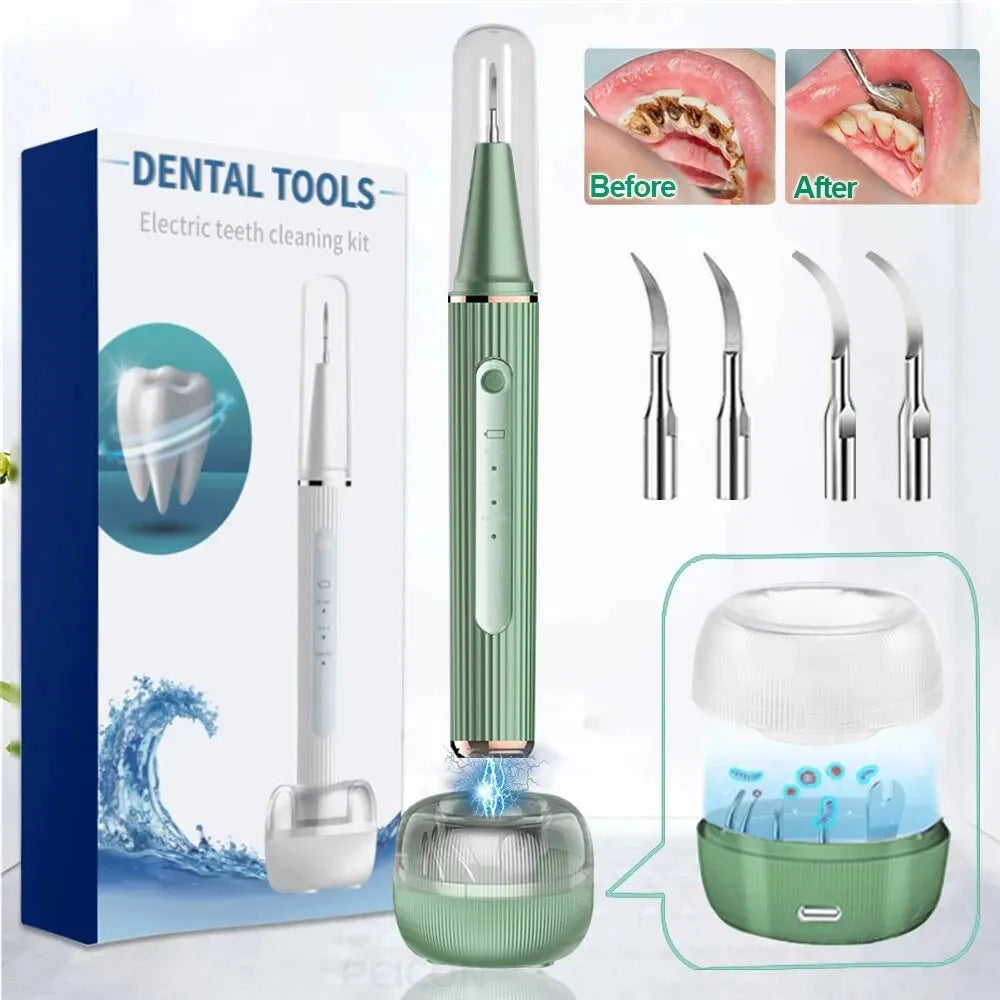 Ultrasonic Dental Whitening