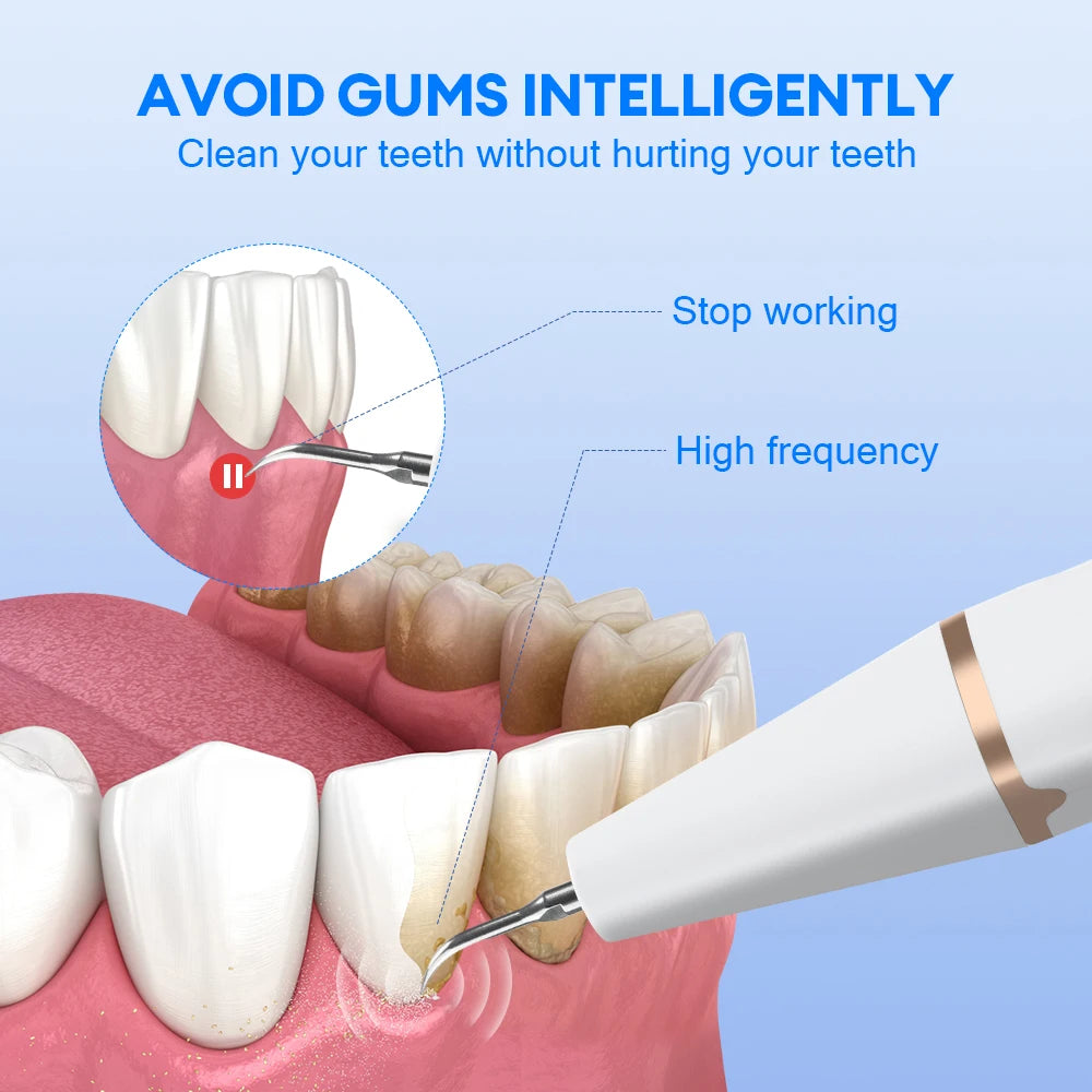 Ultrasonic Dental Tartar Remover