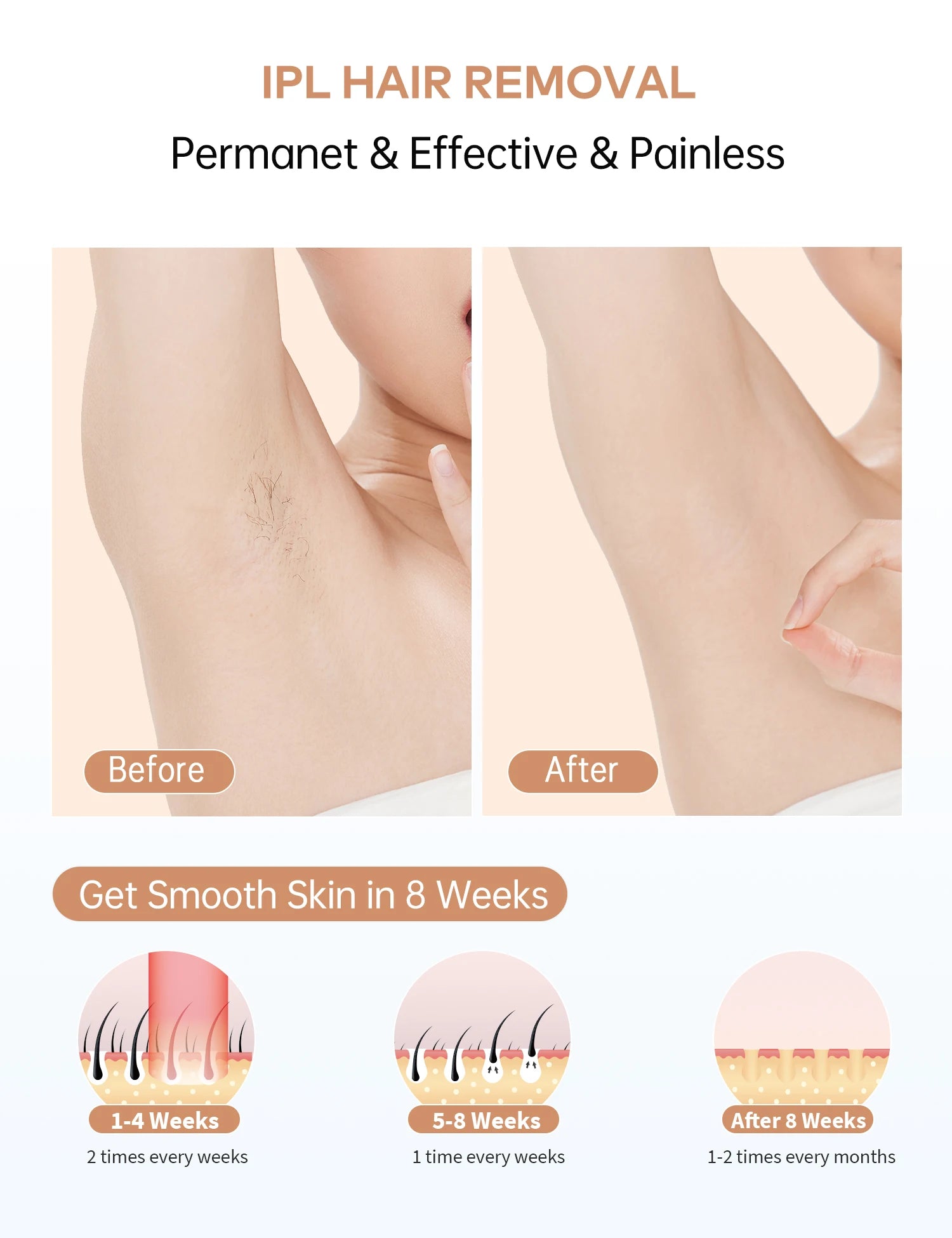 Professional IPL Hair Removal Laser