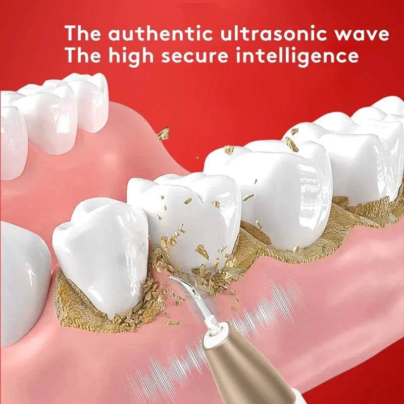 Ultrasonic Dental Remover and Whitening