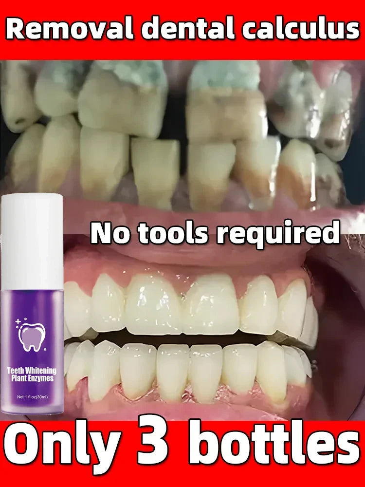 Branqueador Dental